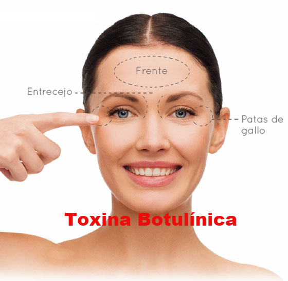 botox, botox toluca, dermatólogos toluca